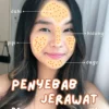 Menguak Misteri Jerawat di Pipi dan Dagu: Lebih dari Sekadar Permukaan Kulit – Menguak Penyebab Mendalamnya