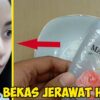 Panduan Lengkap: Cara Efektif Menghilangkan Bekas Jerawat Hitam dan Mendapatkan Kulit Cerah Kembali